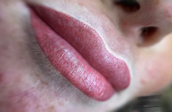 Lip blush after, SM Aesthetics Clinic Margate