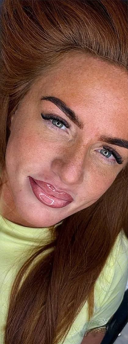 Lip blush after, SM Aesthetics Clinic Margate
