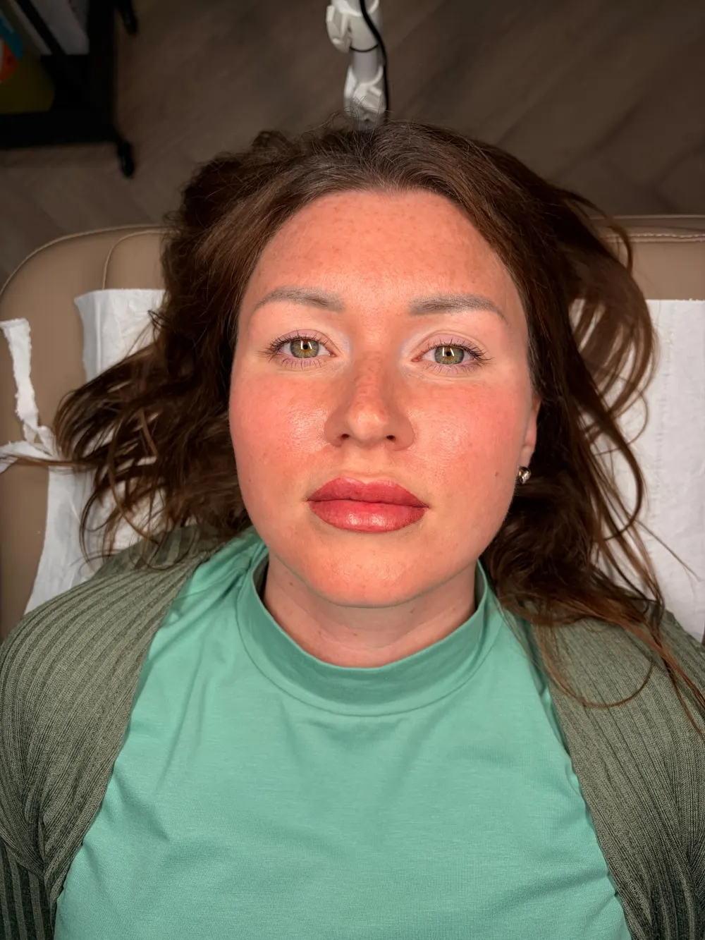 Lip blush after, SM Aesthetics Clinic Margate